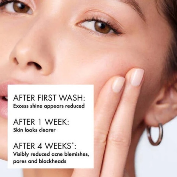 Vichy Normaderm Phytoaction Daily Deep Cleansing Gel with Salicylic Acid - Picture 5 of 15